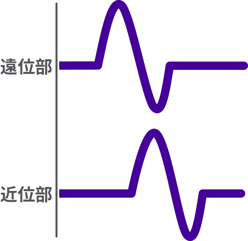 正常な複合筋活動電位(CMAP)