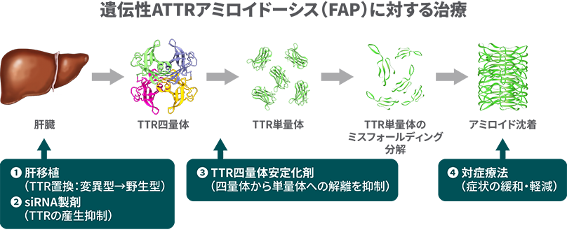 遺伝性ATTRアミロイドーシス(FAP)に対する治療